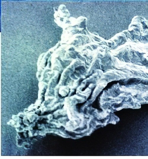 Paro médicale protozoaires Amoeba resisting Microbes