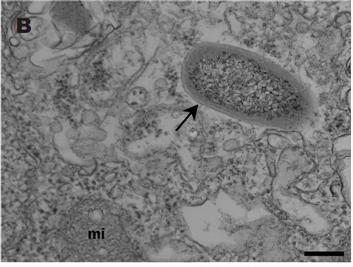 Paro médicale protozoaires Amoeba resisting bacteria